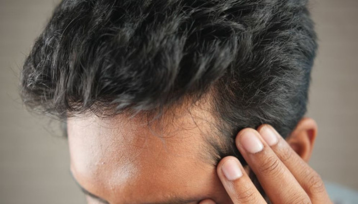 অল্প বয়সে চুল পড়ার কারণ কী? জানালেন বিশেষজ্ঞ