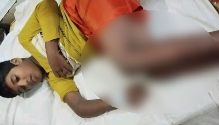 চুরির অপবাদে শিশুকে নির্যাতন, কীটনাশক পান করে হাসপাতালে